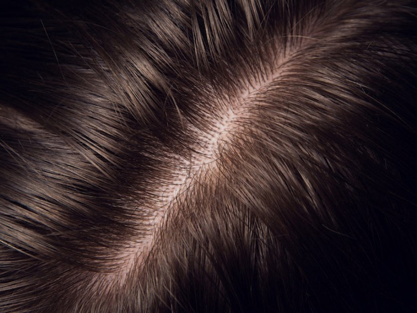 Scalp Care Rituals